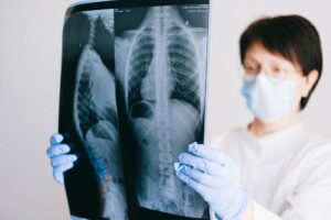 Analyzing Death Imagery in Dreams: Five Patient Case Studies